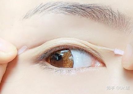 单眼皮贴双眼皮的视频,轻松掌握贴纸魔法教程